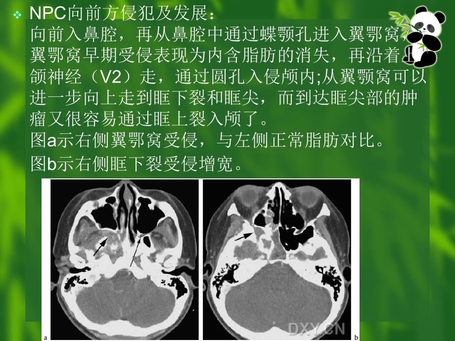 龍魚爛鼻孔：如何判斷龍魚爛鼻孔的嚴重程度