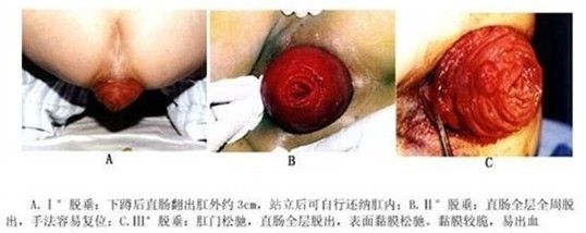 龍魚長(zhǎng)期脫肛怎么辦：如何處理龍魚長(zhǎng)期脫肛