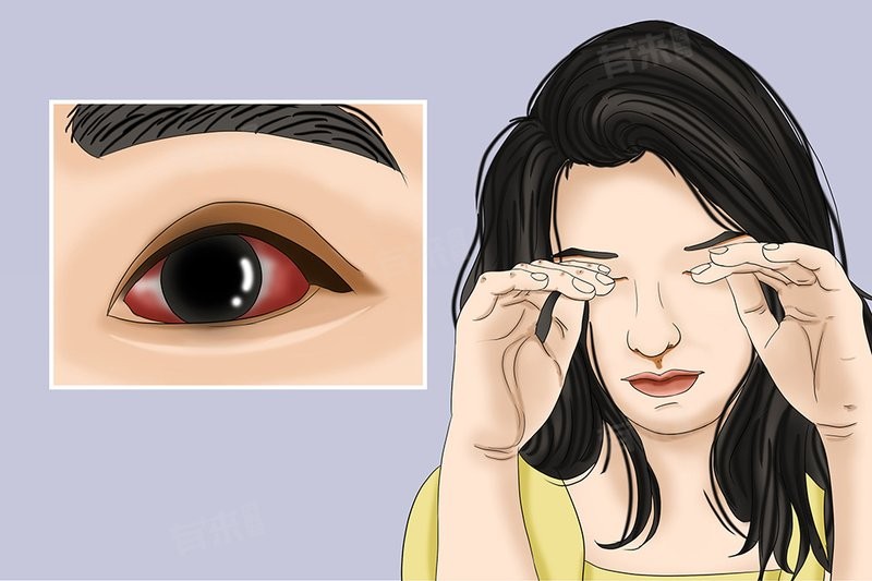 龍眼紅眼需要如何調養