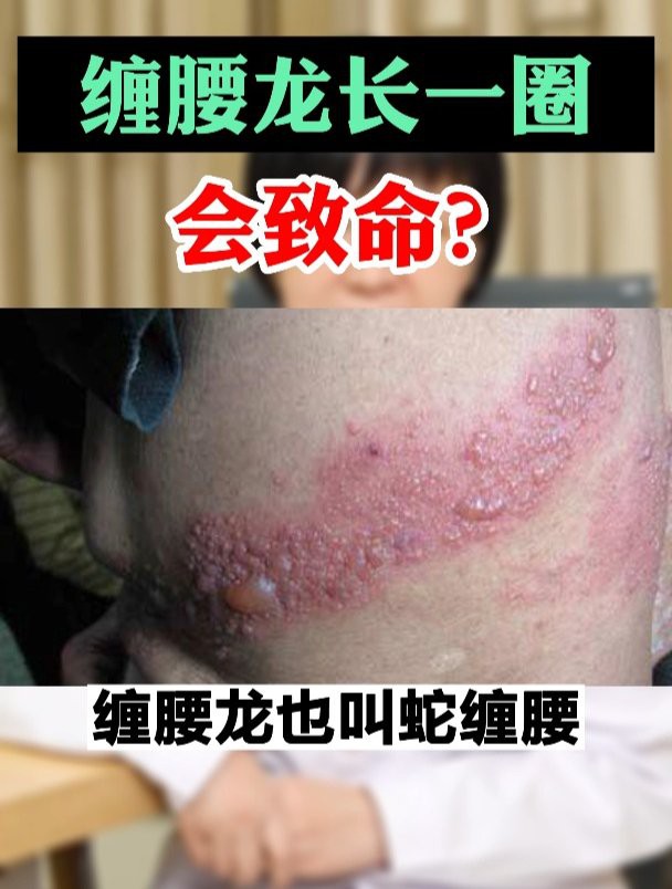 過背金龍患病后多久會死亡？