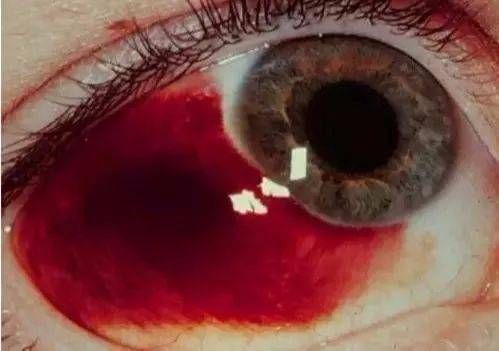 龍魚鱗下出血：龍魚鱗下出血可能是由多種原因引起的，治療方案需要注意