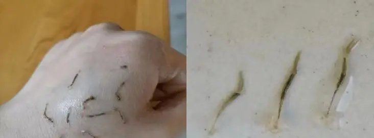 龍魚魚鱗下的寄生蟲