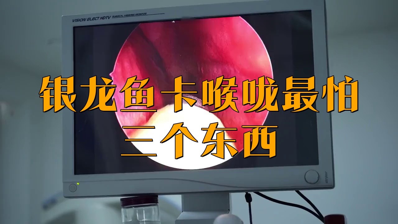 被銀龍魚咬了有事嗎